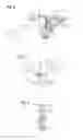 Fig. 03 - Fastening Device for a Mitral Valve and Method