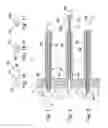 Fig. 02 - Tissue anchor insertion system