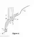 Fig. 05 - SURGICAL INSTRUMENT AND METHOD