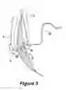 Fig. 06 - SURGICAL INSTRUMENT AND METHOD