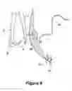 Fig. 07 - SURGICAL INSTRUMENT AND METHOD