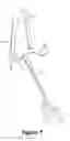 Fig. 08 - SURGICAL INSTRUMENT AND METHOD