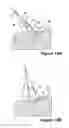Fig. 15 - SURGICAL INSTRUMENT AND METHOD