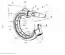 Fig. 01 - GASTRIC RING WITH FACETS