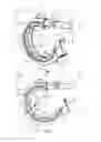 Fig. 02 - GASTRIC RING WITH FACETS
