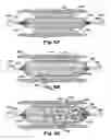 Fig. 05 - Method and apparatus for increasing blood flow through an obstructed blood vessel