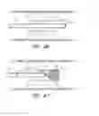 Fig. 58 - THROMBUS MANAGEMENT SYSTEM
