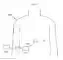 Fig. 31 - Obesity treatment