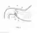 Fig. 02 - DEVICES AND METHODS FOR TREATING GASTROINTESTINAL AND METABOLIC DISORDERS