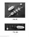 Fig. 05 - DEVICES AND METHODS FOR TREATING GASTROINTESTINAL AND METABOLIC DISORDERS