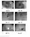 Fig. 08 - DEVICES AND METHODS FOR TREATING GASTROINTESTINAL AND METABOLIC DISORDERS
