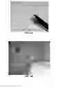Fig. 10 - DEVICES AND METHODS FOR TREATING GASTROINTESTINAL AND METABOLIC DISORDERS
