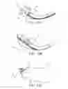 Fig. 15 - DEVICES AND METHODS FOR TREATING GASTROINTESTINAL AND METABOLIC DISORDERS