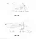 Fig. 16 - DEVICES AND METHODS FOR TREATING GASTROINTESTINAL AND METABOLIC DISORDERS