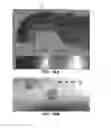 Fig. 20 - DEVICES AND METHODS FOR TREATING GASTROINTESTINAL AND METABOLIC DISORDERS
