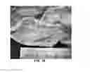 Fig. 23 - DEVICES AND METHODS FOR TREATING GASTROINTESTINAL AND METABOLIC DISORDERS