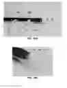 Fig. 24 - DEVICES AND METHODS FOR TREATING GASTROINTESTINAL AND METABOLIC DISORDERS