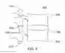 Fig. 05 - Expandable spinal sheath and method of use