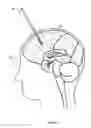 Fig. 03 - MEDICAL DILATOR SYSTEM
