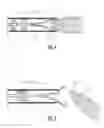 Fig. 03 - Delivery assembly for occlusion device using mechanical interlocking coupling mechanism