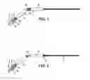Fig. 02 - Extraction kit for a filter for the vena cava