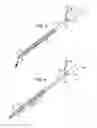 Fig. 03 - Extraction kit for a filter for the vena cava