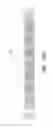Fig. 20 - THROMBUS MANAGEMENT DEVICE