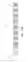 Fig. 23 - THROMBUS MANAGEMENT DEVICE