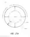 Fig. 35 - THROMBUS MANAGEMENT DEVICE
