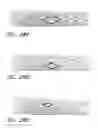 Fig. 44 - THROMBUS MANAGEMENT DEVICE