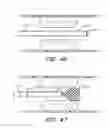 Fig. 58 - THROMBUS MANAGEMENT DEVICE