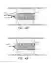 Fig. 59 - THROMBUS MANAGEMENT DEVICE