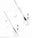Fig. 64 - THROMBUS MANAGEMENT DEVICE