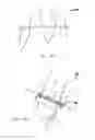 Fig. 08 - Systems and Methods for Treating Septal Defects