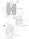 Fig. 12 - Systems and Methods for Treating Septal Defects
