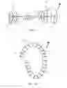 Fig. 15 - Systems and Methods for Treating Septal Defects