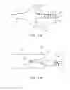 Fig. 30 - Systems and Methods for Treating Septal Defects