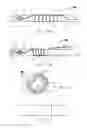 Fig. 31 - Systems and Methods for Treating Septal Defects