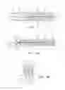 Fig. 05 - Needle Apparatus for Closing Septal Defects and Methods for Using Such Apparatus
