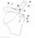 Fig. 01 - MEDICAL DEVICE AND PROCEDURE FOR ATTACHING TISSUE TO BONE