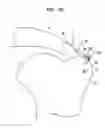 Fig. 09 - MEDICAL DEVICE AND PROCEDURE FOR ATTACHING TISSUE TO BONE