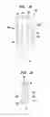 Fig. 11 - MEDICAL DEVICE AND PROCEDURE FOR ATTACHING TISSUE TO BONE