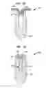 Fig. 13 - MEDICAL DEVICE AND PROCEDURE FOR ATTACHING TISSUE TO BONE