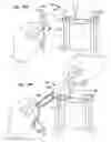 Fig. 47 - MEDICAL DEVICE AND PROCEDURE FOR ATTACHING TISSUE TO BONE