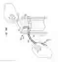 Fig. 48 - MEDICAL DEVICE AND PROCEDURE FOR ATTACHING TISSUE TO BONE