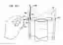 Fig. 50 - MEDICAL DEVICE AND PROCEDURE FOR ATTACHING TISSUE TO BONE