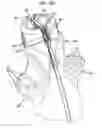Fig. 59 - MEDICAL DEVICE AND PROCEDURE FOR ATTACHING TISSUE TO BONE