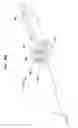 Fig. 72 - MEDICAL DEVICE AND PROCEDURE FOR ATTACHING TISSUE TO BONE