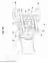 Fig. 77 - MEDICAL DEVICE AND PROCEDURE FOR ATTACHING TISSUE TO BONE