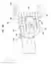 Fig. 82 - MEDICAL DEVICE AND PROCEDURE FOR ATTACHING TISSUE TO BONE